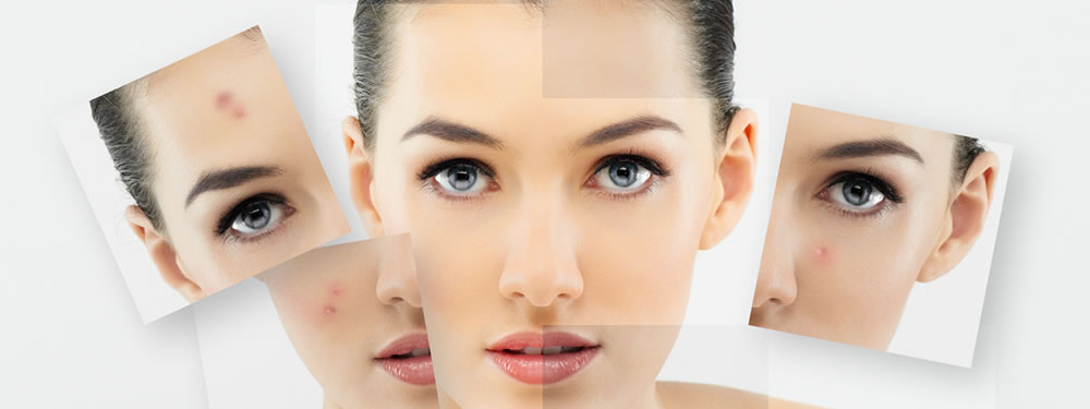 Cosmeceutical Treatment Therapy
